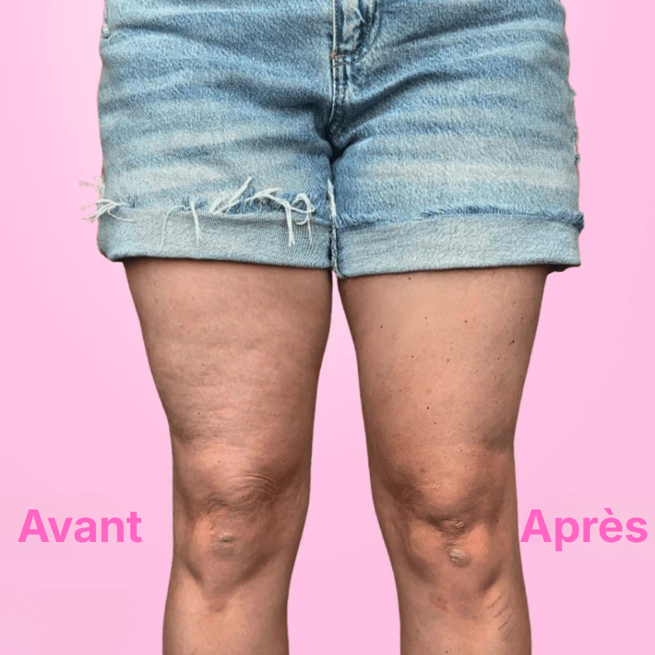 InstaLift - Jambes