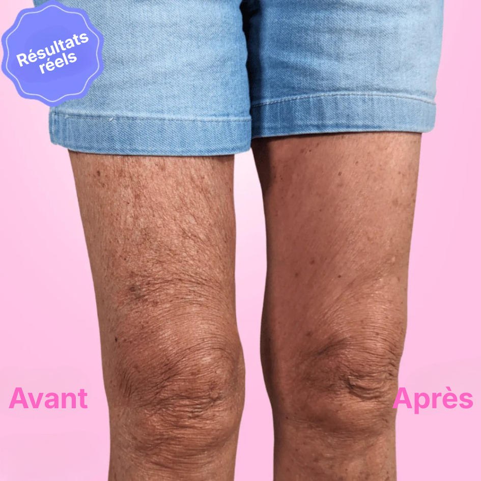 InstaLift - Jambes